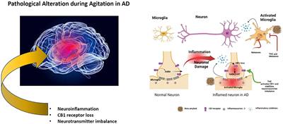 Neurobiological alteration in agitation in Alzheimer’s disease and possible interventions